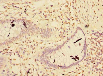 RNF181 Polyclonal Antibody