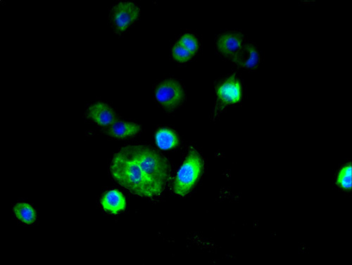 RNF182 Polyclonal Antibody