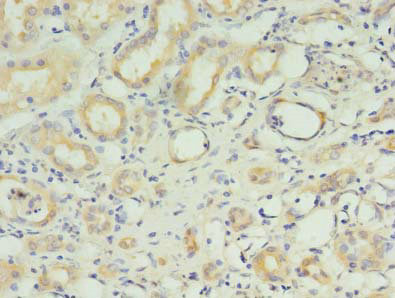 RNF183 Polyclonal Antibody