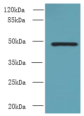 RNF26 Polyclonal Antibody