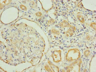 RNF31 Polyclonal Antibody