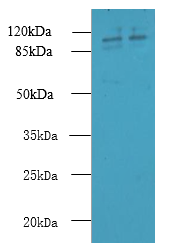 RPGR Polyclonal Antibody