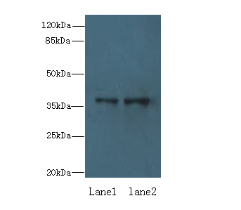 RPRD1B Polyclonal Antibody