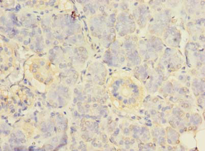 RPS24 Polyclonal Antibody