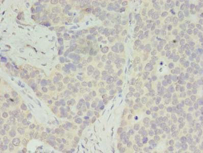RPS28 Polyclonal Antibody