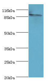 RRM1 Polyclonal Antibody
