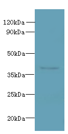 RSPH14 Polyclonal Antibody