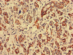 RTCA Polyclonal Antibody
