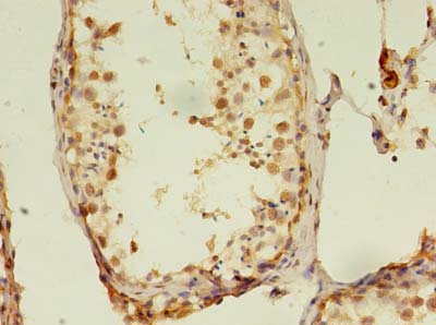 RTKN2 Polyclonal Antibody