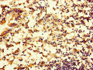 RTN4IP1 Polyclonal Antibody