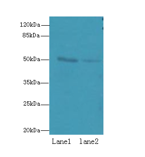 RUNDC3A Polyclonal Antibody