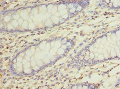 RUSC1 Polyclonal Antibody