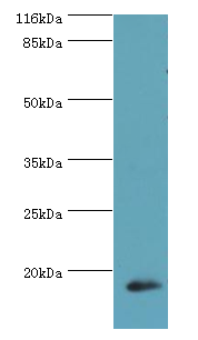 S100A9 Polyclonal Antibody