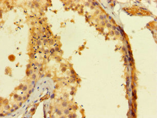 SAMSN1 Polyclonal Antibody