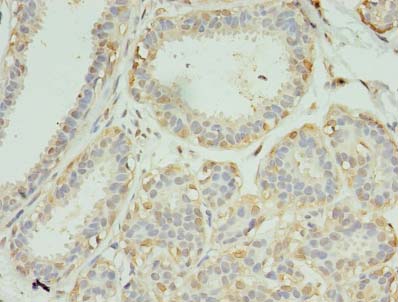 SCAMP4 Polyclonal Antibody
