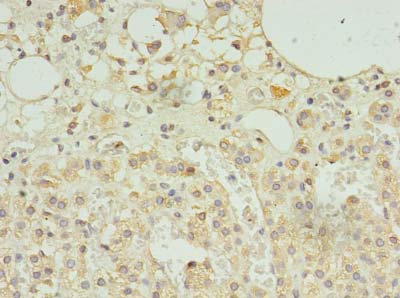 SCAMP5 Polyclonal Antibody