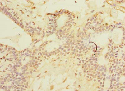 SCNM1 Polyclonal Antibody