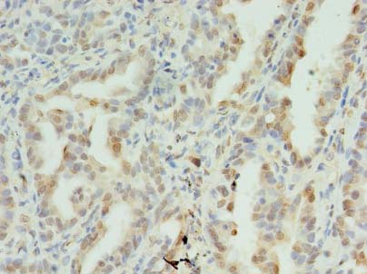 SDHC Polyclonal Antibody
