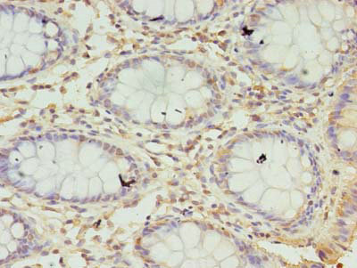 SEC11A Polyclonal Antibody
