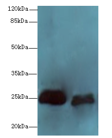SERTAD1 Polyclonal Antibody
