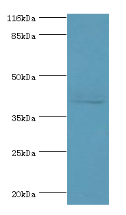 KRT19 Polyclonal Antibody