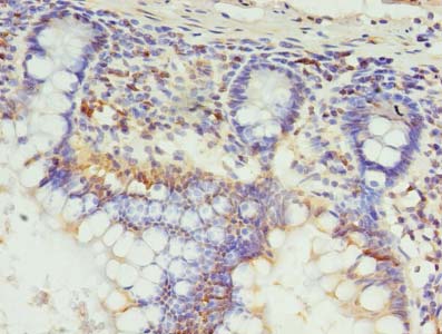 SETX Polyclonal Antibody