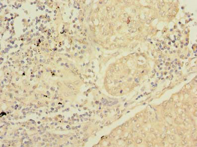 SFTPC Polyclonal Antibody