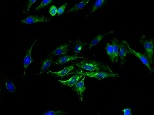 SGMS2 Polyclonal Antibody