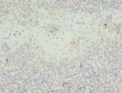 SH3BGRL Polyclonal Antibody