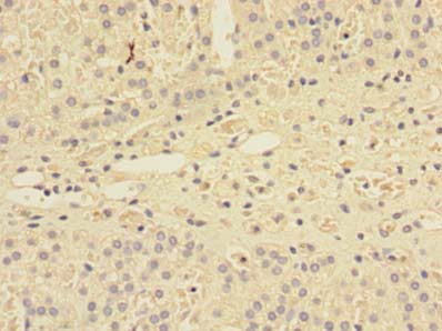 SHISA5 Polyclonal Antibody