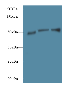 SIGLEC6 Polyclonal Antibody