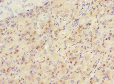 SIPA1L2 Polyclonal Antibody