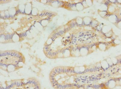 Immunohistochemistry of paraffin-embedded human small intestine using SLC23A1 Polyclonal Antibody at dilution of 1:100