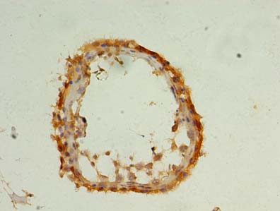 SLC25A26 Polyclonal Antibody