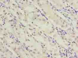 SLC52A2 Polyclonal Antibody