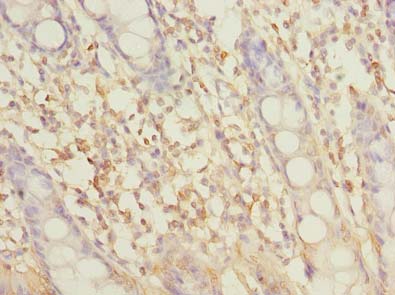 SLC6A16 Polyclonal Antibody