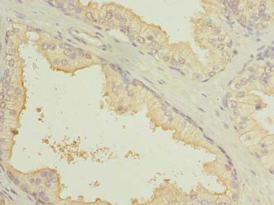SLC7A14 Polyclonal Antibody