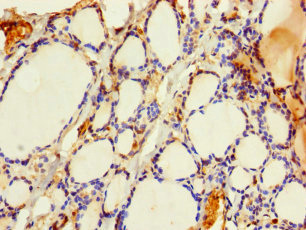 PRELID3B Polyclonal Antibody