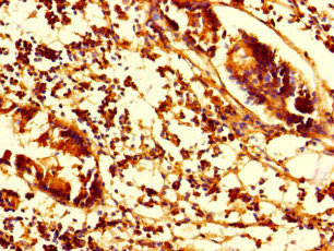 SMAP1 Polyclonal Antibody