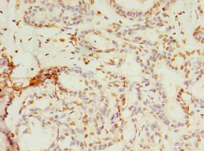 SMPDL3A Polyclonal Antibody