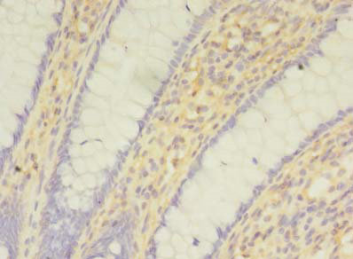 SNAI1 Polyclonal Antibody