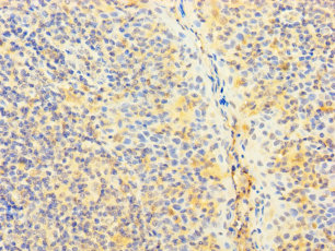 SNX22 Polyclonal Antibody