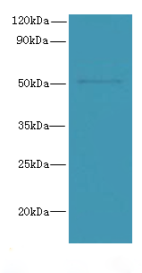 SNX6 Polyclonal Antibody