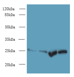 Socs3 Polyclonal Antibody