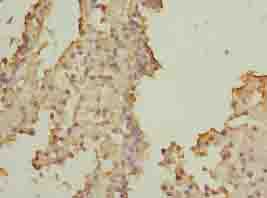 SOHLH2 Polyclonal Antibody