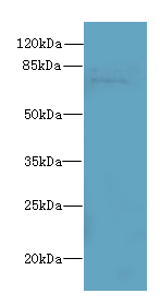 SORBS3 Polyclonal Antibody