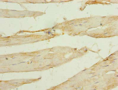 Immunohistochemistry of paraffin-embedded human Skeletal muscle tissue at dilution of 1:100