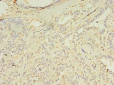 SPIC Polyclonal Antibody