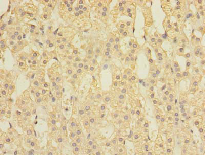 SPOP Polyclonal Antibody