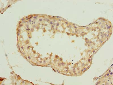 SPRTN Polyclonal Antibody